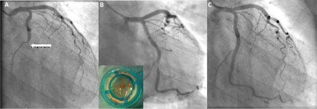 graphic file with name clinmed-16-3-278fig1.jpg