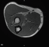 Figure 1c