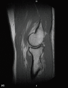 Figure 1d