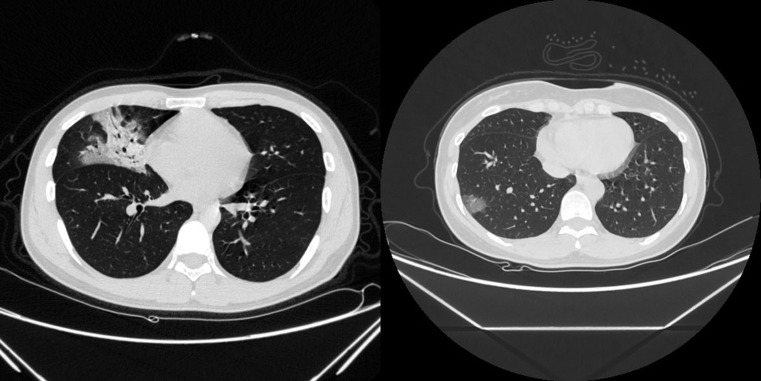 Figure 2