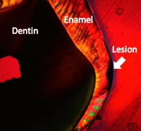 Fig. 10