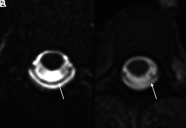 FIG 1.