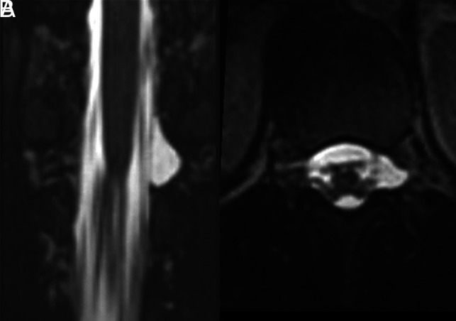 FIG 2.
