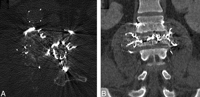 Fig 3.