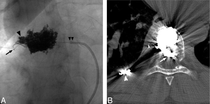 Fig 4.