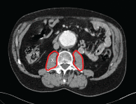 Graphical Abstract