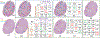 Fig. 13.