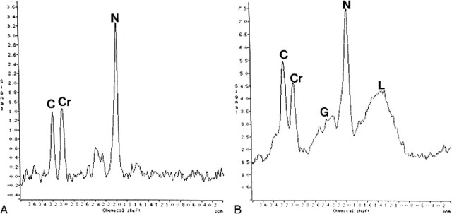 fig 2.