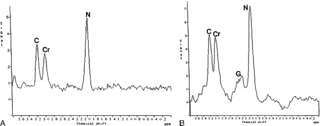 fig 3.