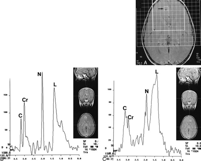 fig 4.