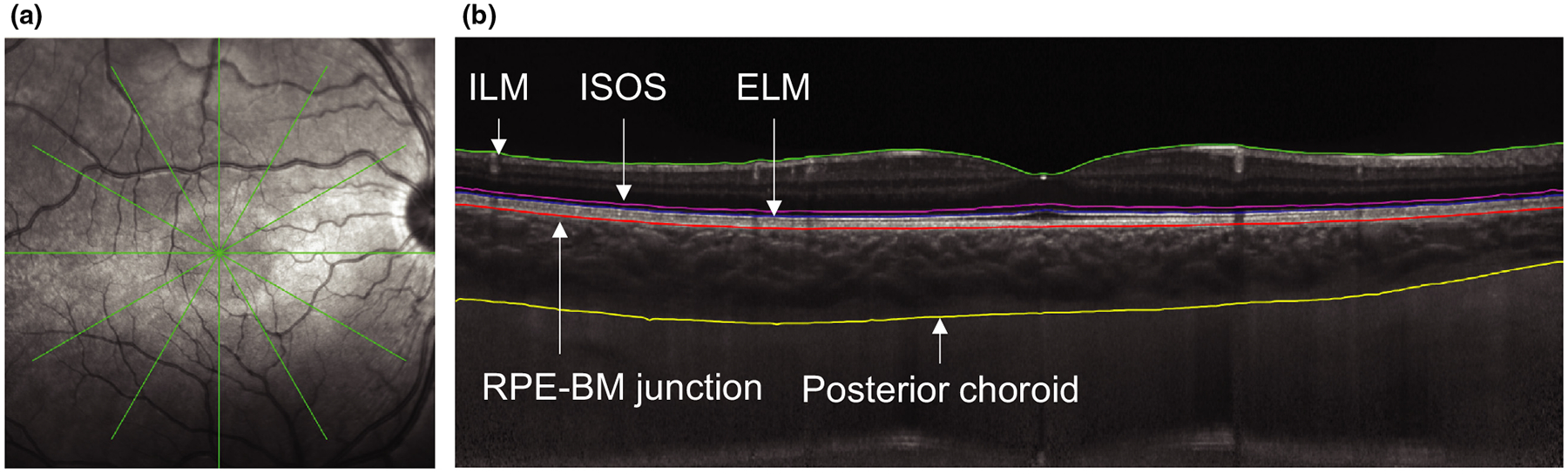 Figure 2.