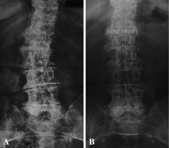 Fig. 2A–B