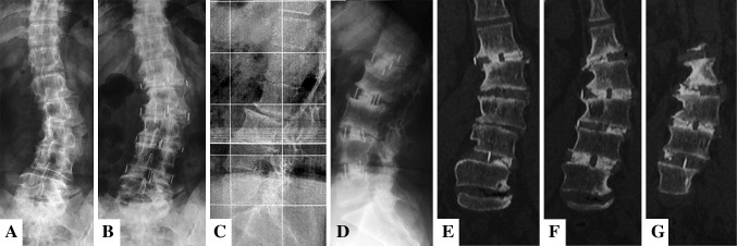 Fig. 4A–G