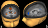 Figure. 2