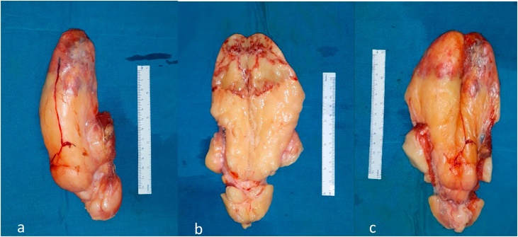 Fig. 5