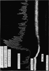 172-1