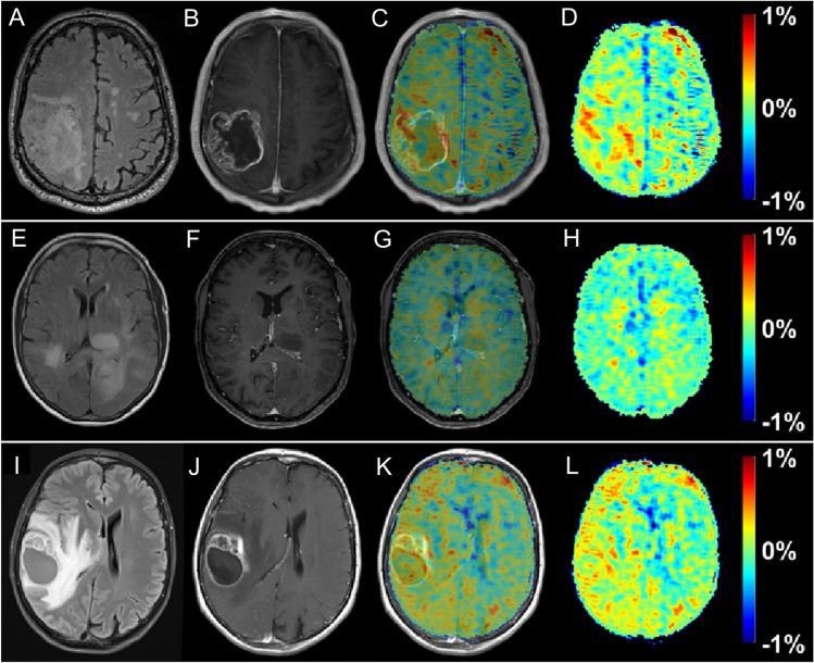 Fig. 12