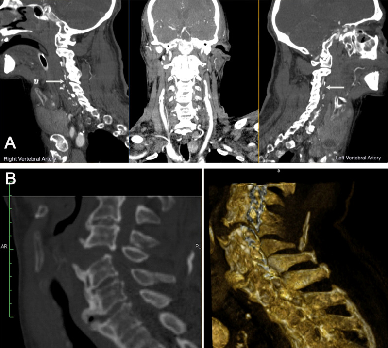 Fig. (1)