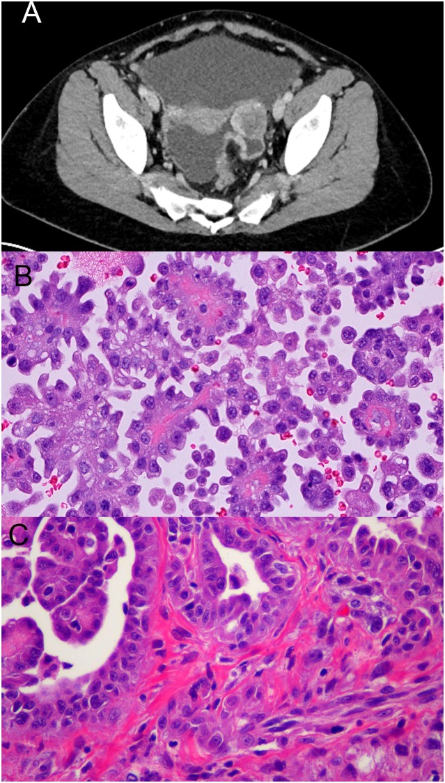 Fig 1