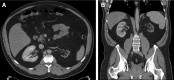 <b>FIG. 1.</b>