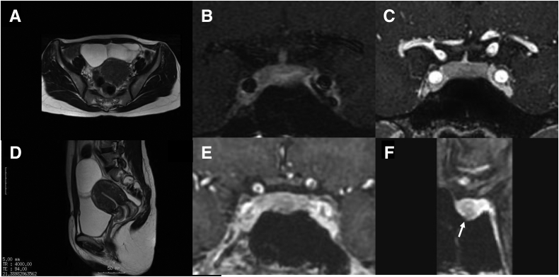 Figure 1