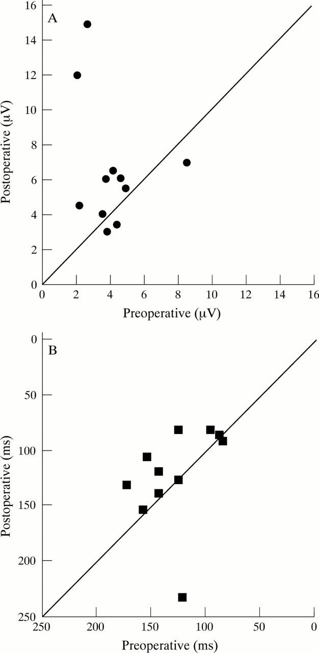 Vitreopapillary traction in proliferative diabetic vitreoretinopathy - PMC