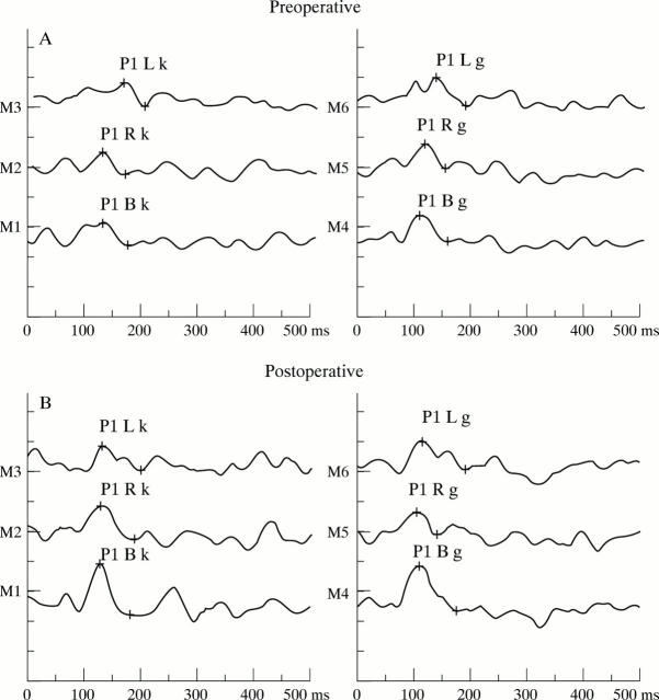 Figure 4  