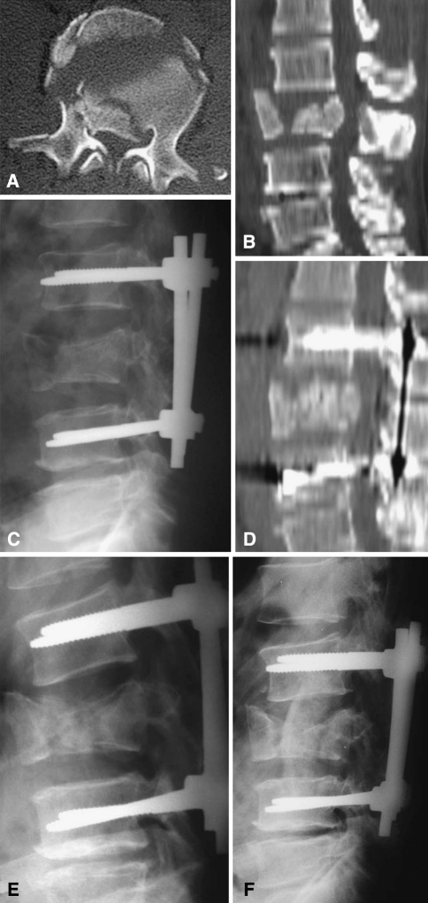 Fig. 3