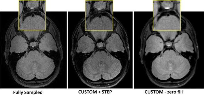 Fig. 2