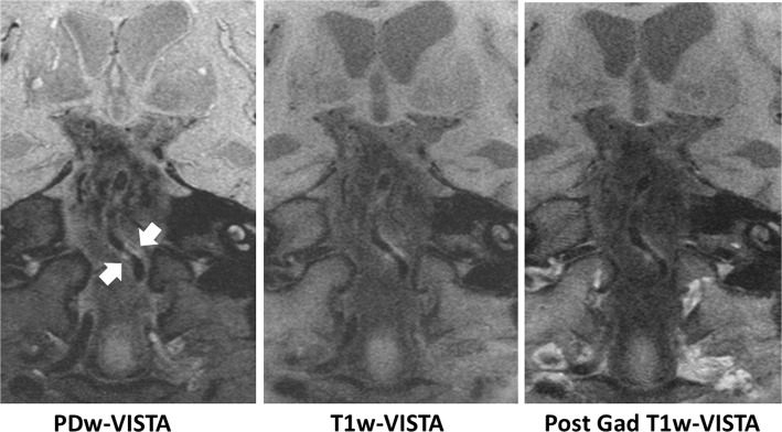 Fig. 7