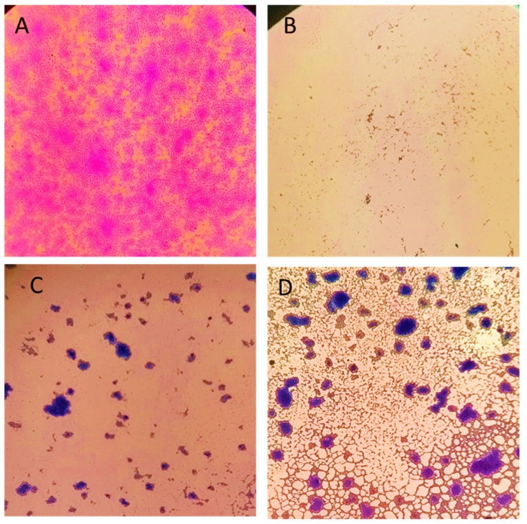 Figure 11