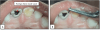 Fig. 4