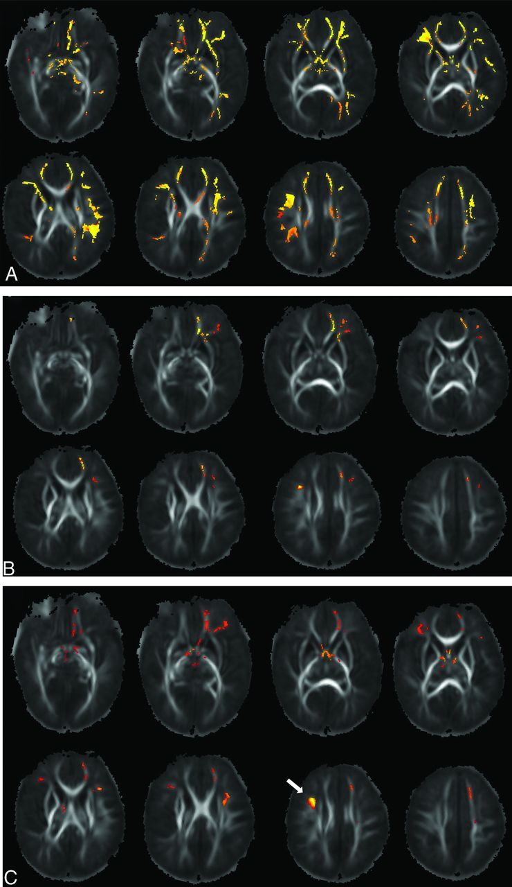 FIG 1.