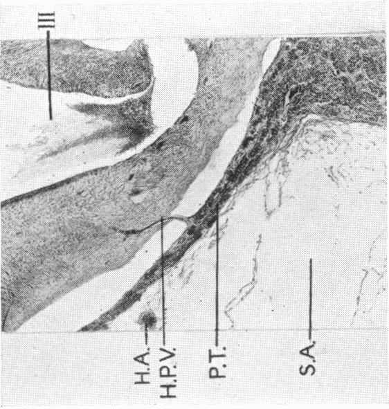 Fig. 11