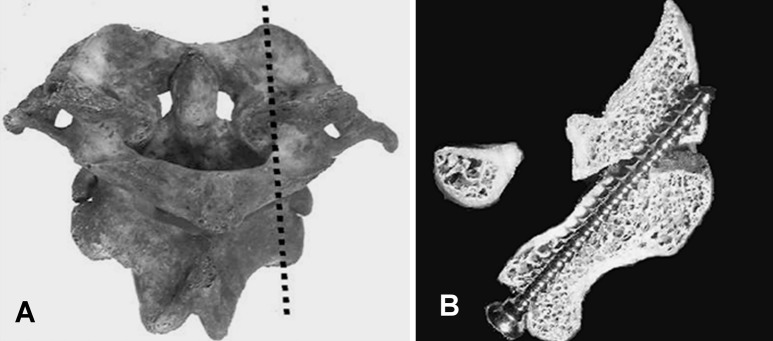 Fig. 2