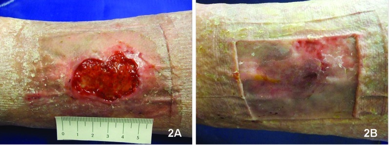 Figure 2A and 2B