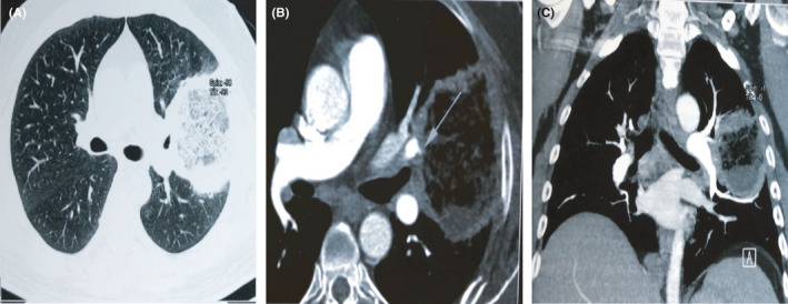 FIGURE 3