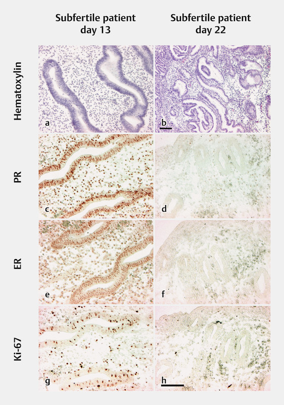 Fig. 1