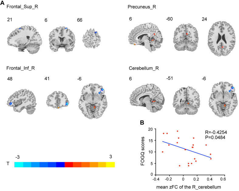 FIGURE 4