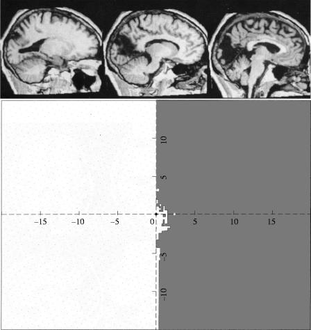 Figure 20