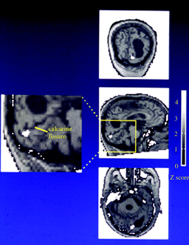 Figure 18