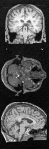 Figure 22