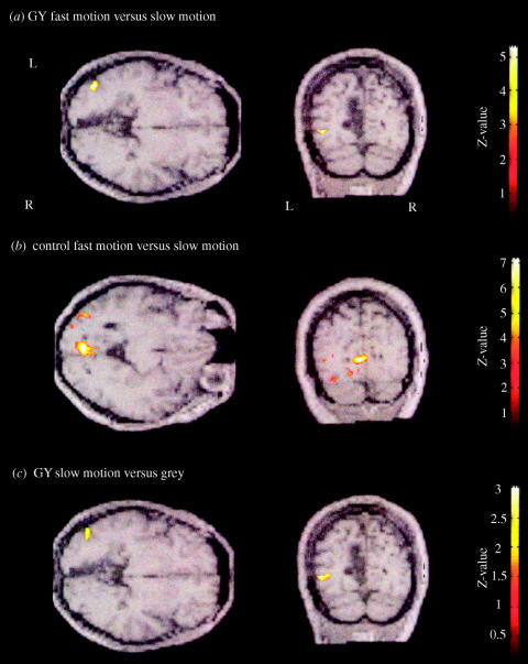 Figure 21