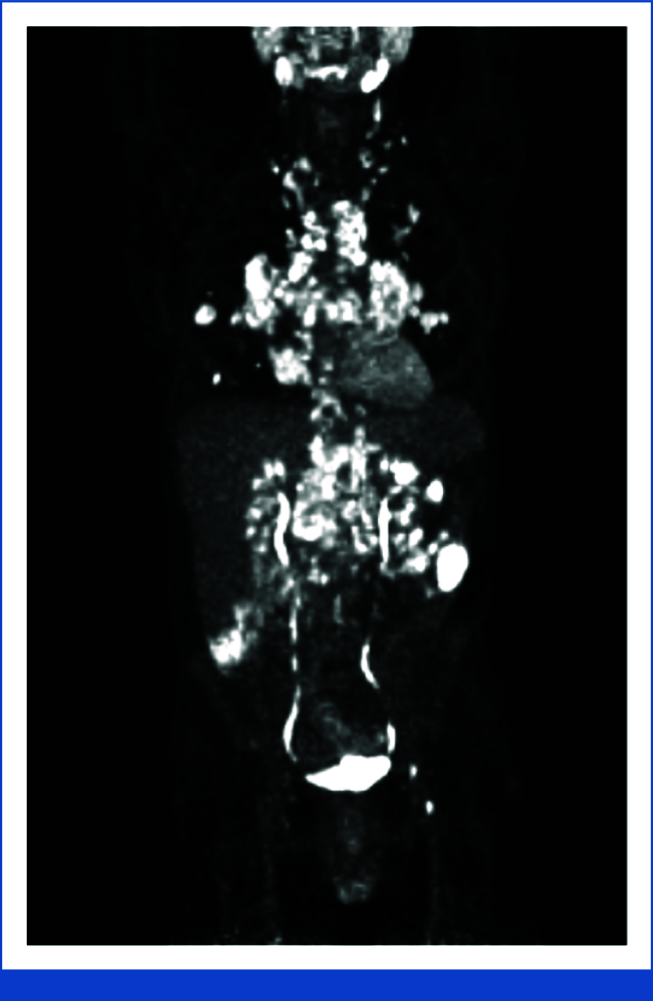 FIG 1.