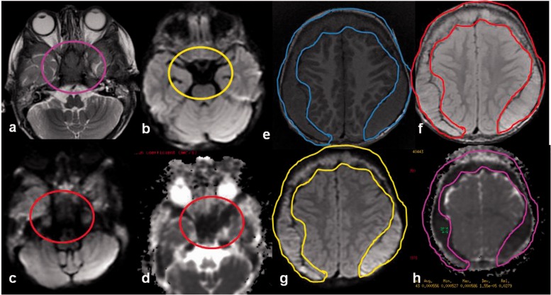 Figure 14.