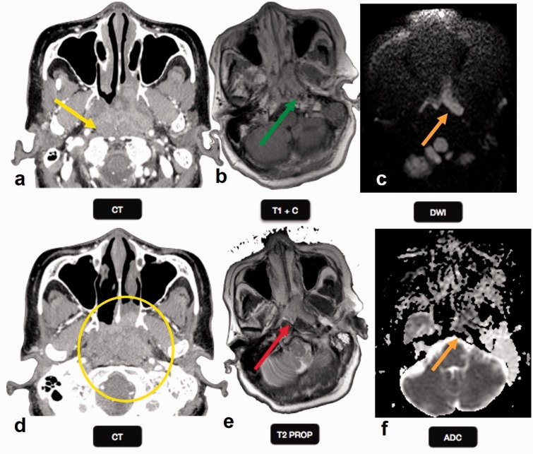 Figure 13.