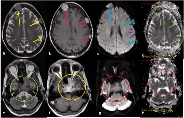 Figure 15.