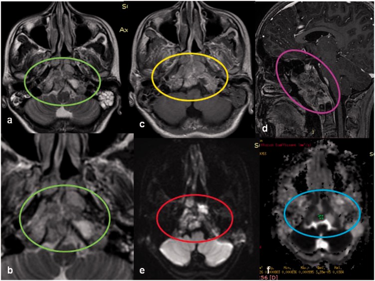 Figure 12.