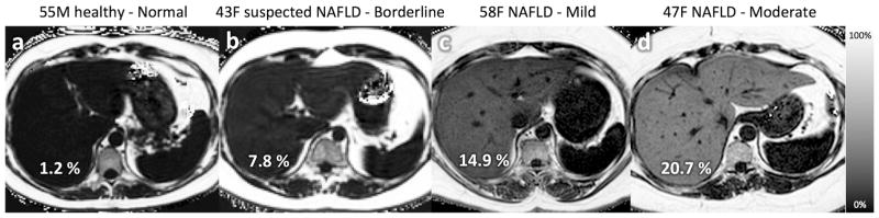 Fig. 4