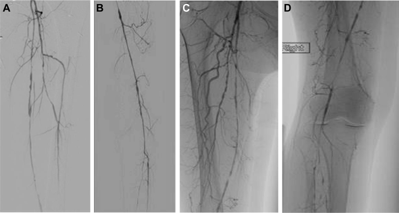 Fig 1